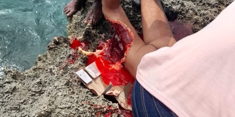 Fallece turista tras ser mordido por un tiburón