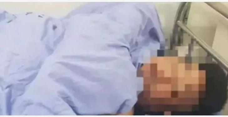Le cortó los genitales a su marido por embarazar a su mejor amiga