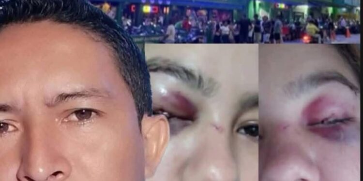 Indignación en Sincelejo: Hombre golpea brutalmente a una mujer y sigue en libertad